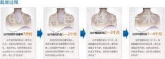 综߶ʲôҪ